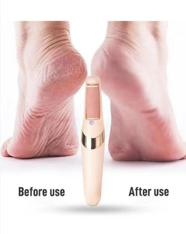 WEIMEI Electronic Pedicure Tool with Dual Heads (Rechargeable)